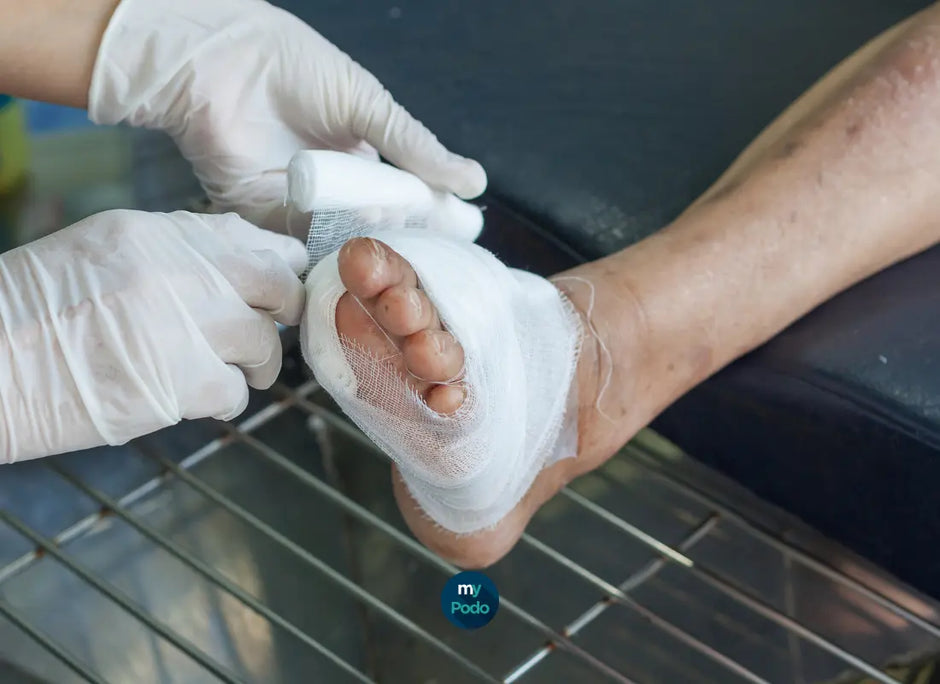 Combien de temps garder un pansement compressif ? My Podologie