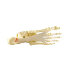 Modelo de Fascite Plantar – Pé/Tornozelo