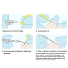 Fios de ortonixia Ortogrip - Com aplicador - Ruck