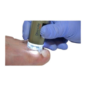 Microscope Médical - Podoscope 1,3 MP - Dino-Lite Dino-Lite 