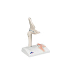 Mini articulação do quadril com corte transversal, na base - Anatomia e patologia