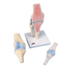 Modelo seccional da articulação do joelho, em 3 partes - Anatomia e patologia