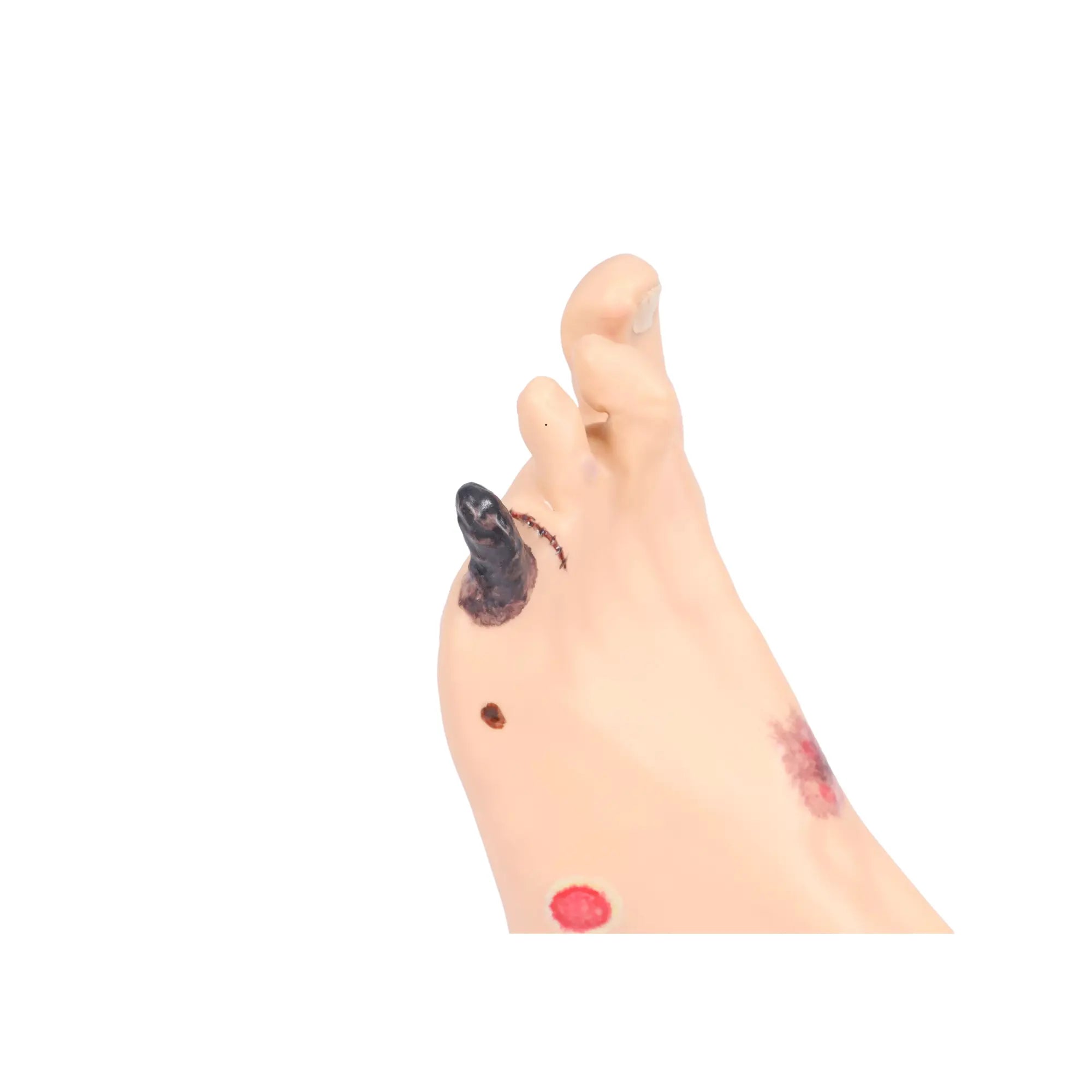 Modelo de pé com feridas - Anatomia e patologia Minha Podologia 