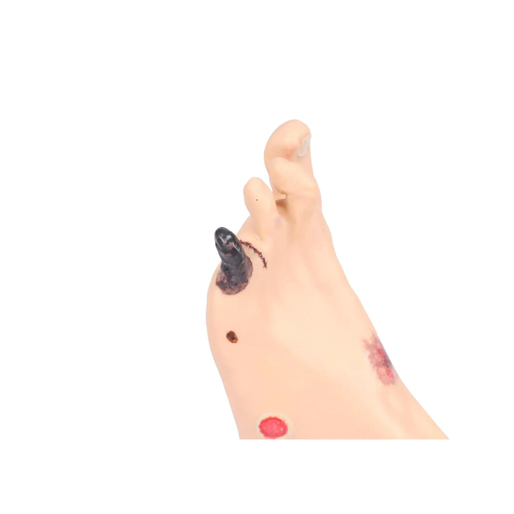 Modelo de pé com feridas - Anatomia e patologia Minha Podologia 