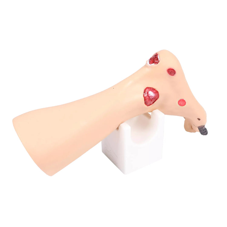 Modelo de pé com feridas - Anatomia e patologia Minha Podologia 