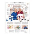 Quadro anatômico - Doença de Alzheimer - Anatomia e patologia