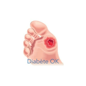 Pedicure Podorape - Grão fino e médio - 16 cores disponíveis - Podorape 27 cm 